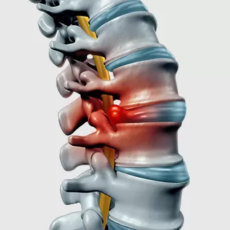 thoat vi dai dem 1.jpg