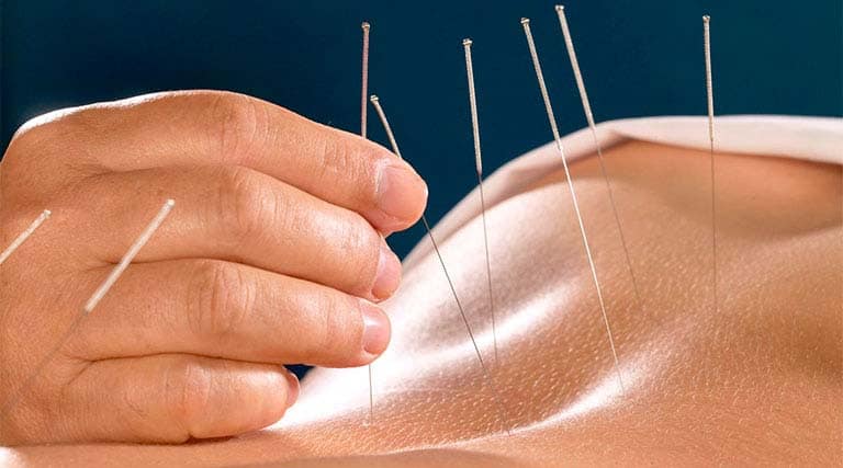 học chăm cứu ở cần thơ