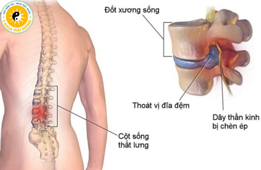 10 lợi ích nổi bật của nắn chỉnh xương khớp