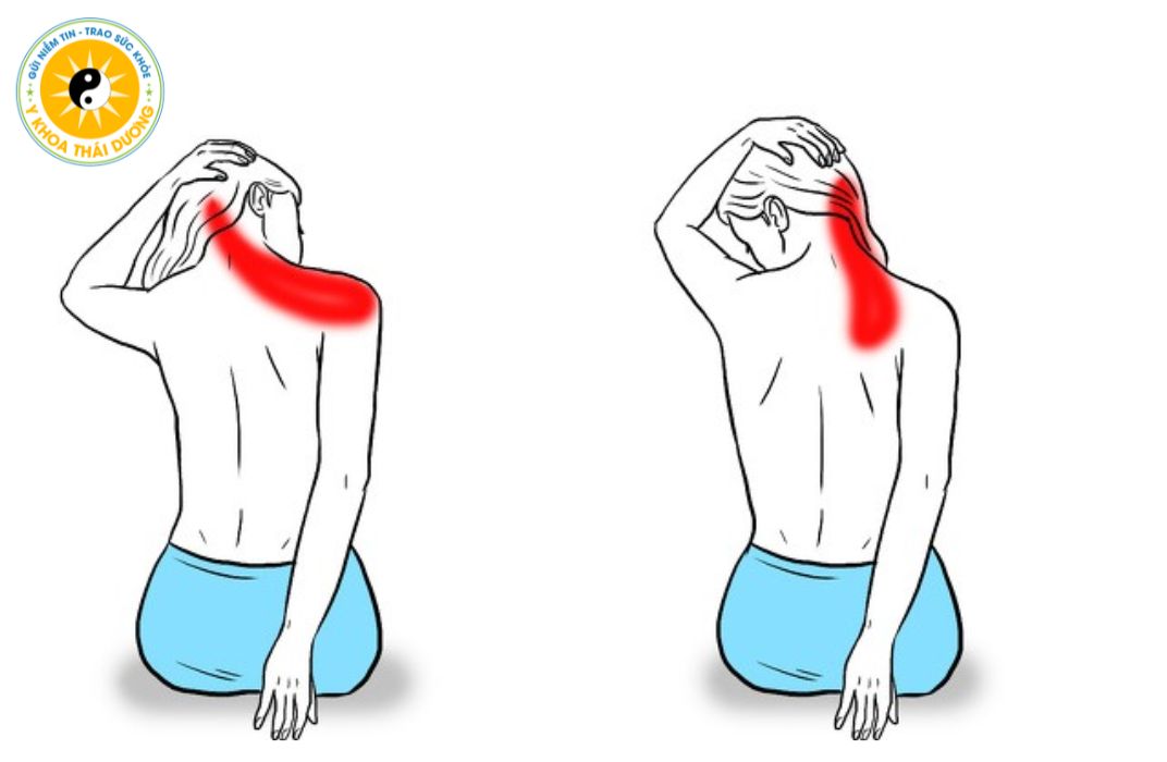 Bài tập giảm đau cổ vai gáy: Hiệu quả nhanh, dễ thực hiện