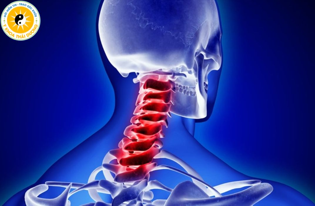 Bài tập thoái hóa đốt sống cổ cho dân văn phòng: Giảm đau, tăng linh hoạt cột sống