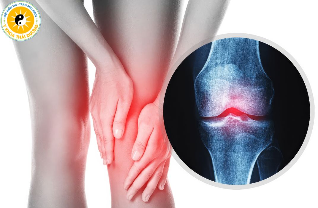 Cách giảm đau viêm khớp an toàn không dùng thuốc