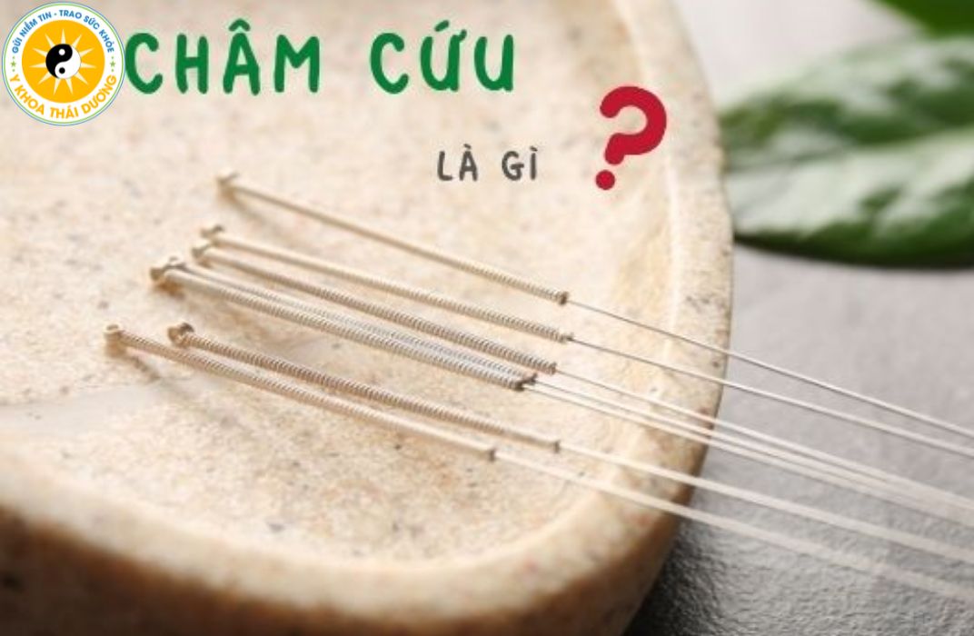 Châm cứu có tác dụng gì? Ai nên và ai không nên thực hiện?