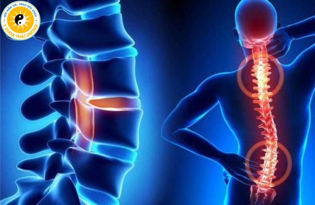 Chấn thương cột sống nguy hiểm ra sao?