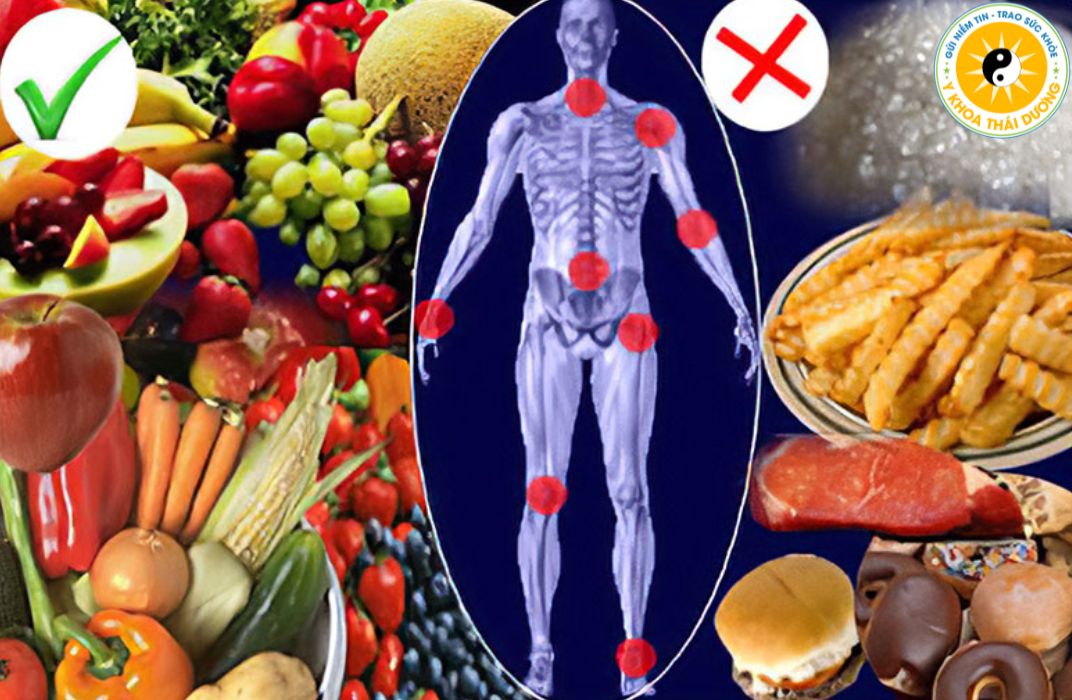 Chế độ ăn hỗ trợ xương khớp: Thực phẩm nên dùng và cần tránh