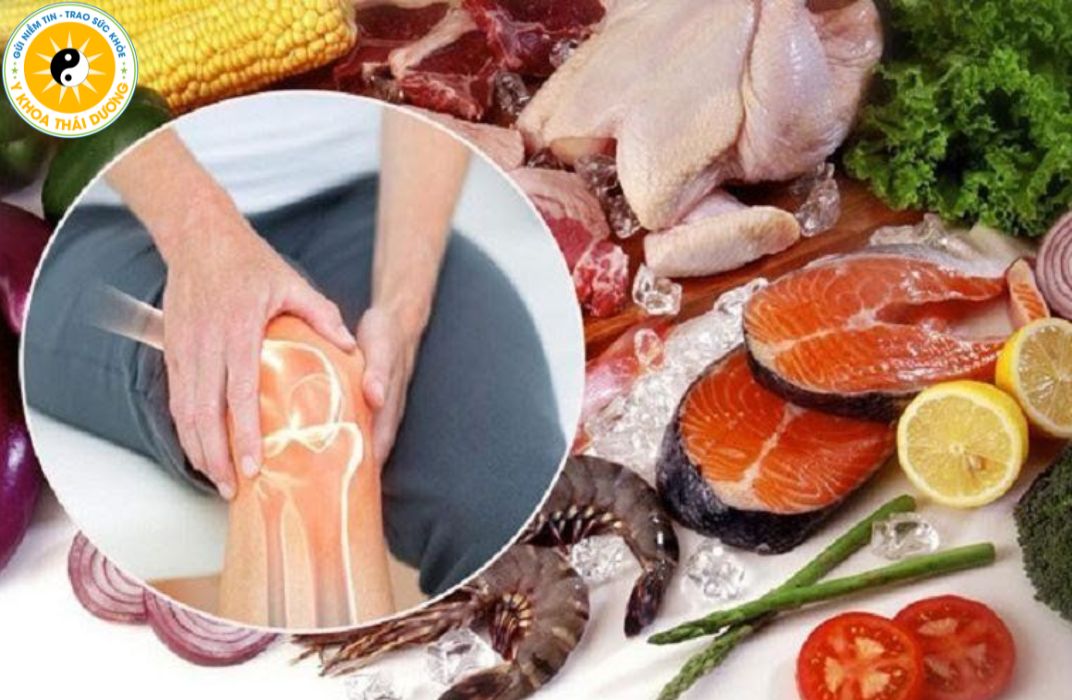 Chế độ ăn hỗ trợ xương khớp: Thực phẩm nên dùng và cần tránh