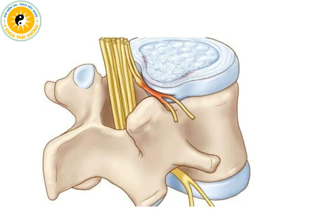 Chiropractic là gì? Trị liệu nắn chỉnh cột sống 