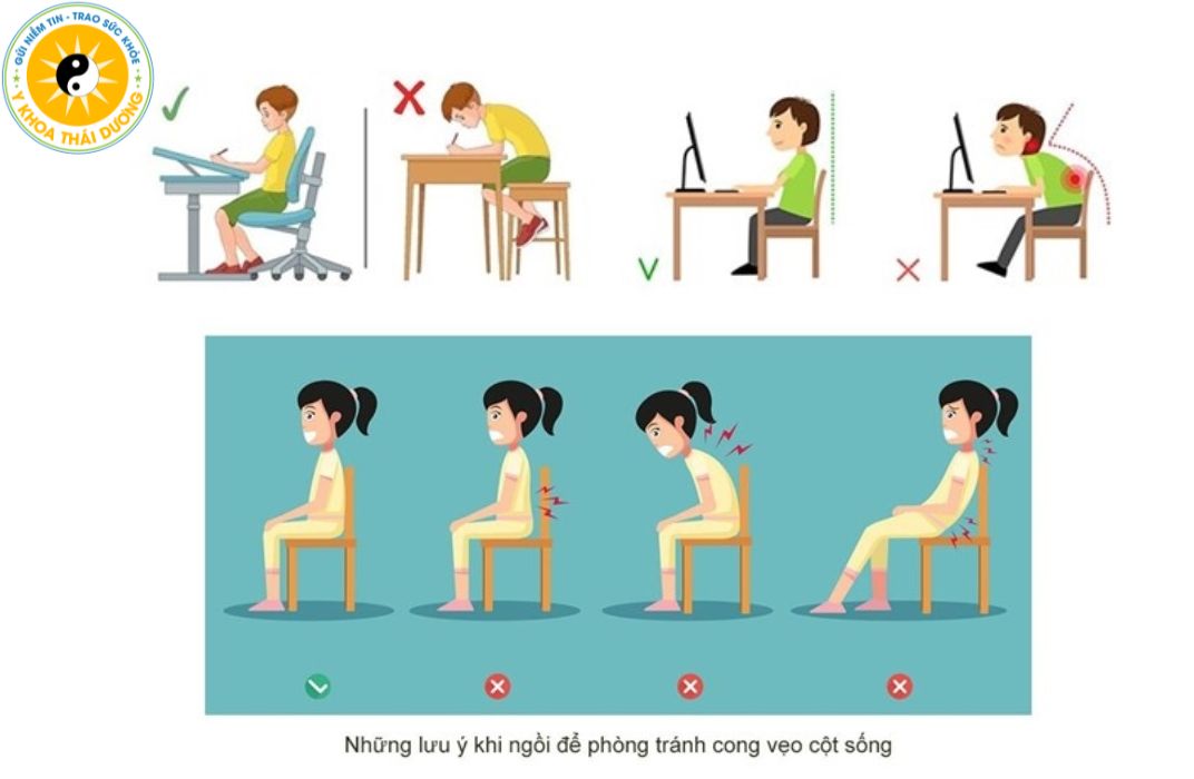 Vì sao học sinh dễ bị cong vẹo cột sống? Nguyên nhân, dấu hiệu nhận biết