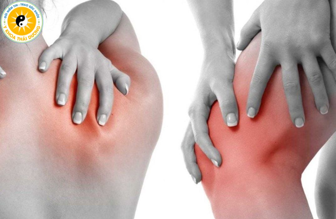 Đau cơ là gì? 10 cách giảm đau nhức cơ bắp hiệu quả