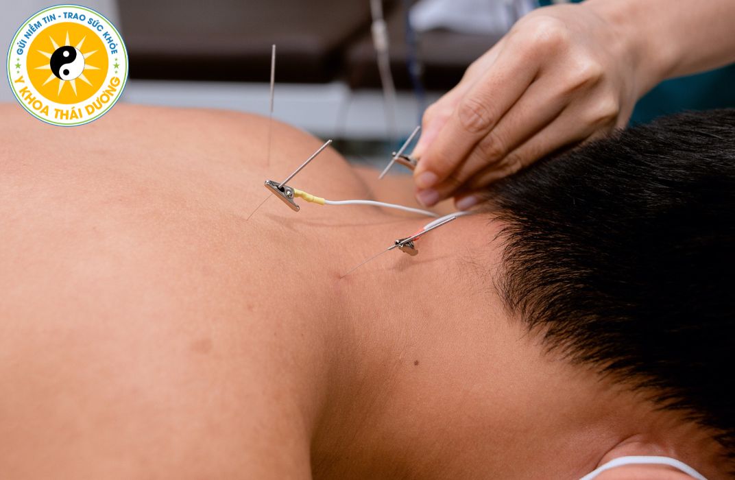 Đau cổ vai gáy: Nguyên nhân, dấu hiệu và phương pháp điều trị hiệu quả