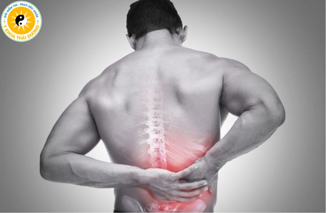 Đau lưng cấp tính: Cách xử lý đúng để tránh biến chứng lâu dài