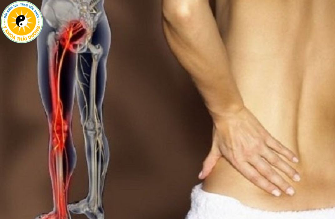 Đau lưng tê chân: Cảnh báo sớm bệnh lý cột sống
