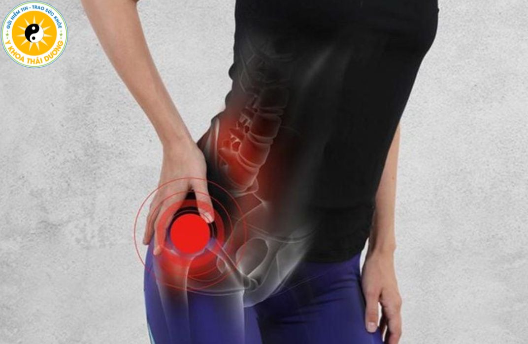 Đau thần kinh tọa: Triệu chứng nhận biết và phương pháp điều trị 