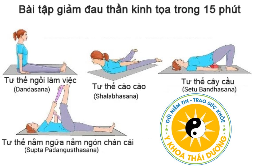 Đau thần kinh tọa: Cách nhận biết sớm và giải pháp điều trị chuẩn y khoa