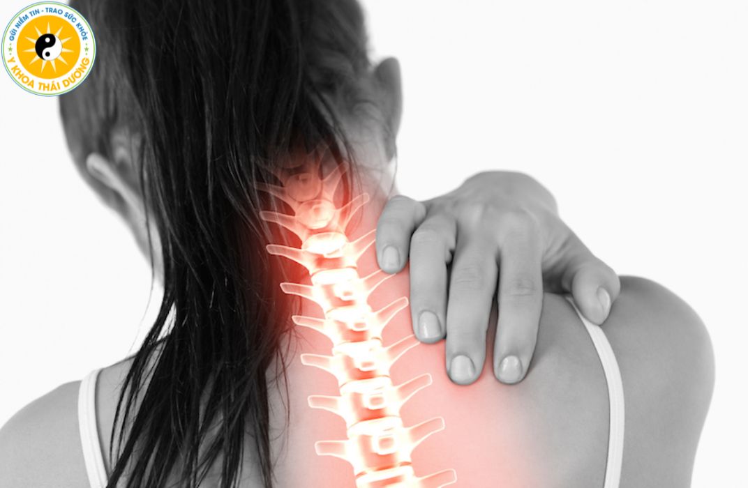Đau vai gáy không quay được cổ: Nguyên nhân và cách xử lý