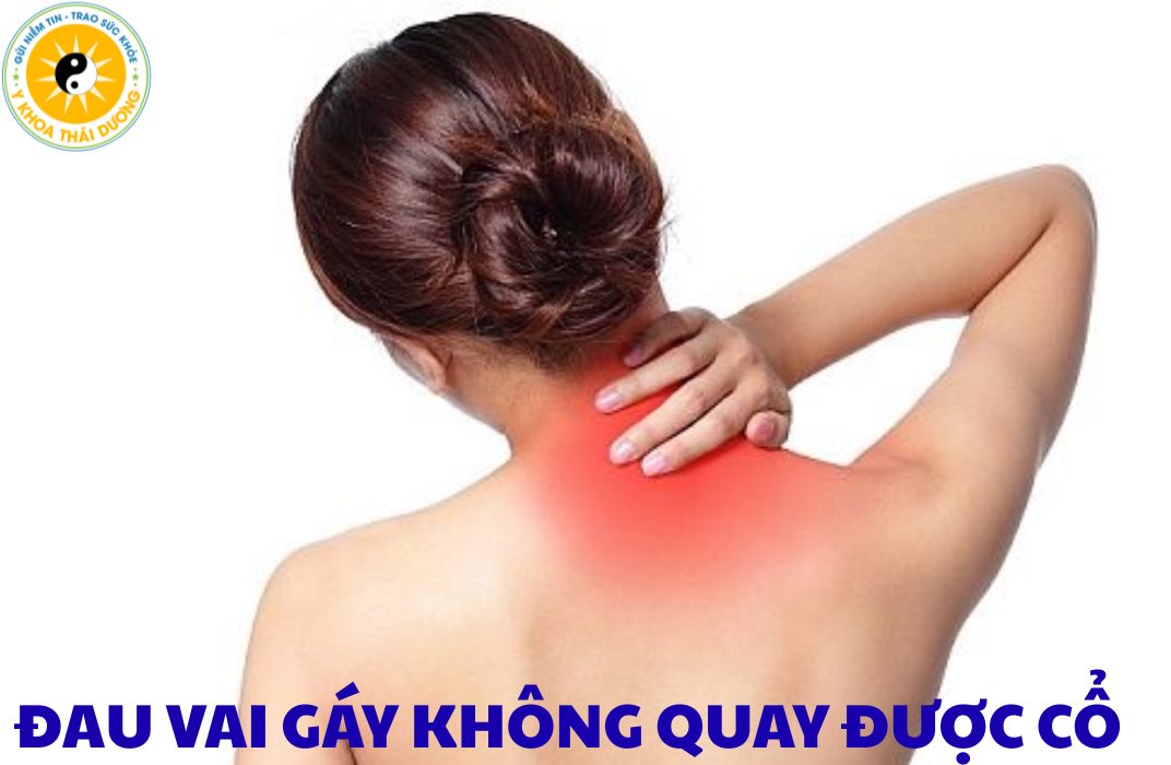 Đau vai gáy không quay được cổ: Nguyên nhân và cách xử lý