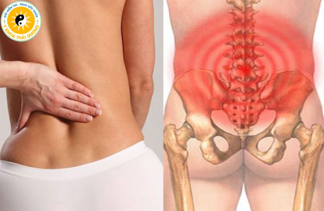 Điều trị đau lưng khi mang thai và sau sinh: Những lưu ý quan trọng