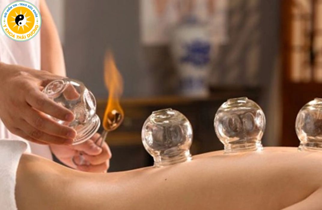 Giác hơi có tác dụng gì? Lợi ích đối với sức khỏe