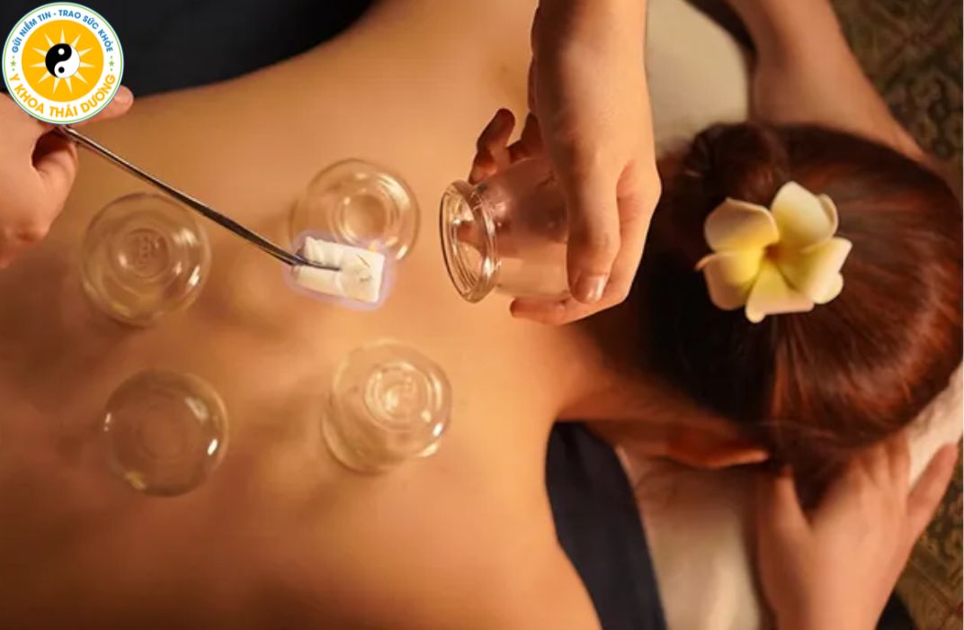 Giác hơi có tác dụng gì? Lợi ích đối với sức khỏe