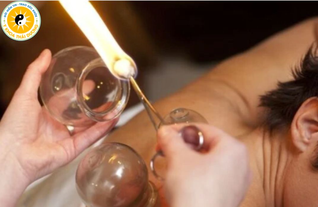 Giác hơi có tác dụng gì? Lợi ích đối với sức khỏe