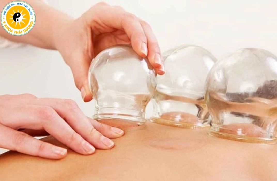 Giác hơi trị liệu: Khi nào nên thực hiện và lưu ý quan trọng