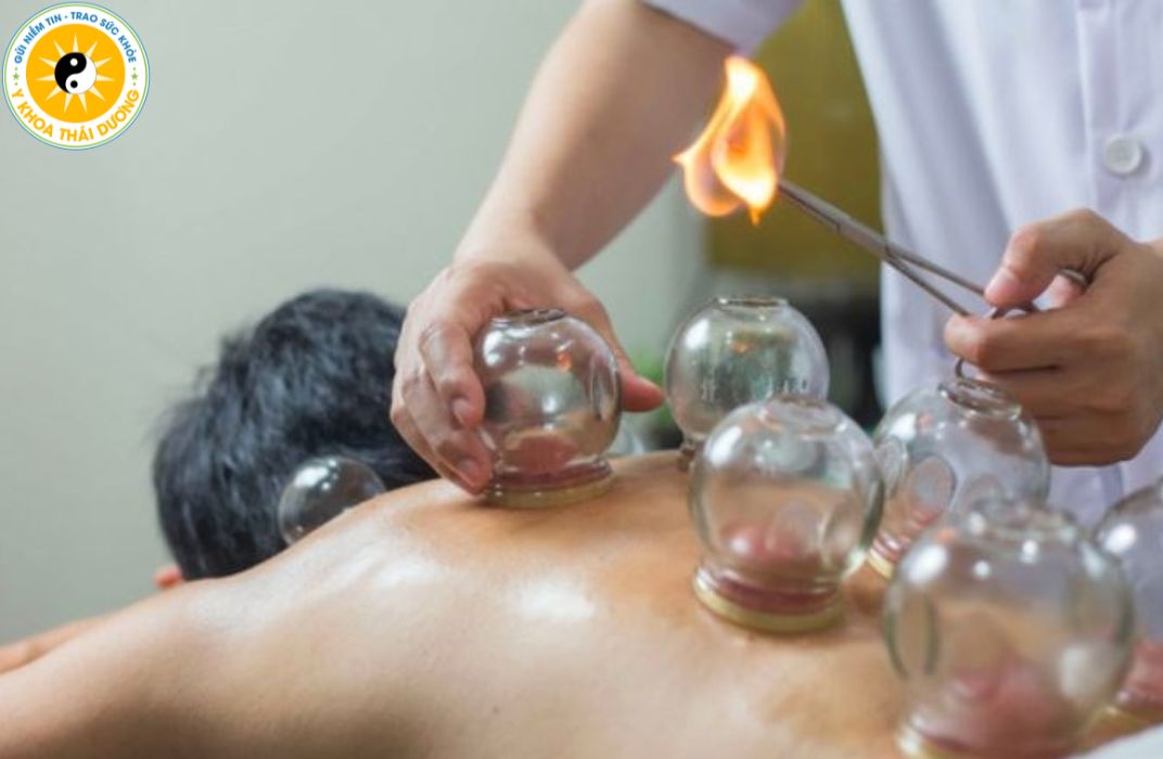 Giác hơi trị liệu: Khi nào nên thực hiện và lưu ý quan trọng