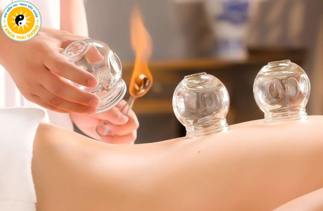 Giác hơi trị liệu: Khi nào nên thực hiện và lưu ý quan trọng