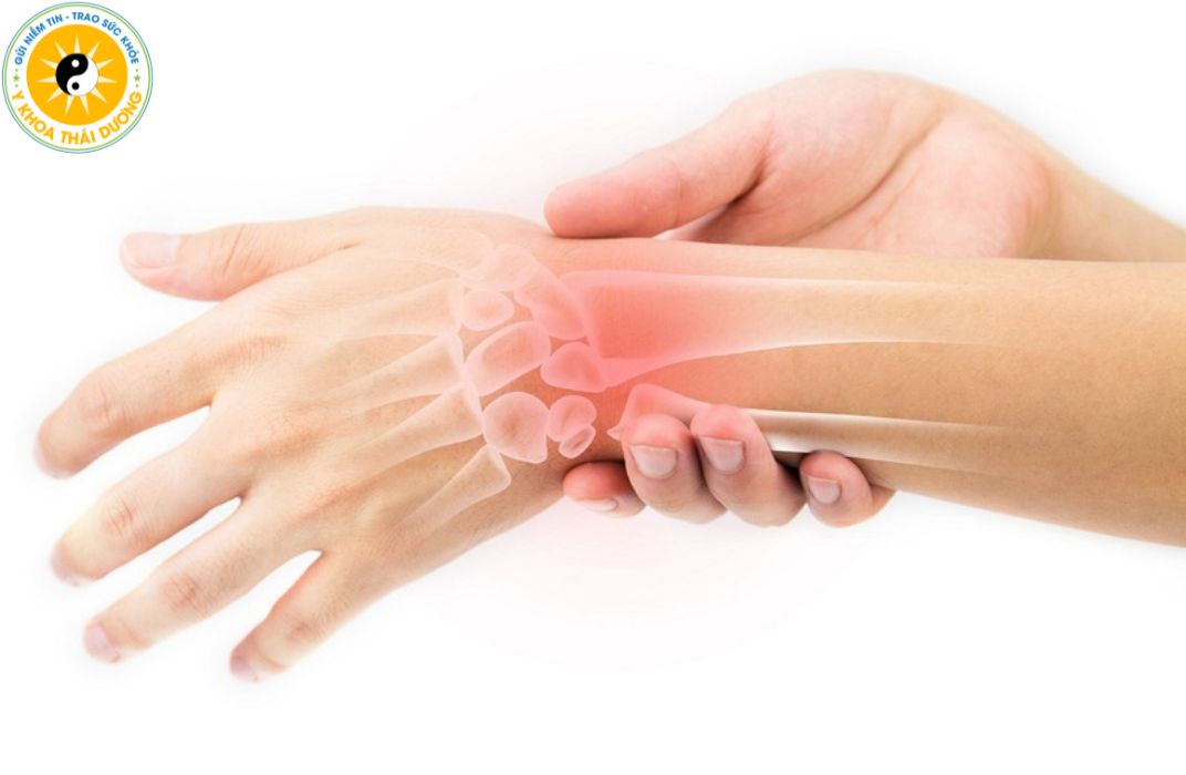 Hội chứng ống cổ tay ở nhân viên văn phòng: Nguyên nhân và cách phòng ngừa