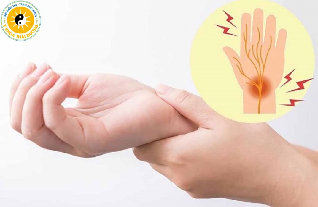 Hội chứng ống cổ tay: Những biến chứng nguy hiểm