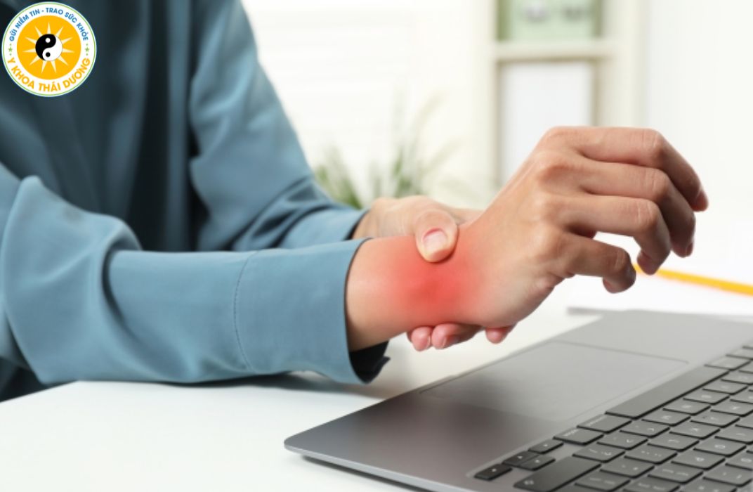 Hội chứng ống cổ tay ở nhân viên văn phòng: Nguyên nhân và cách phòng ngừa