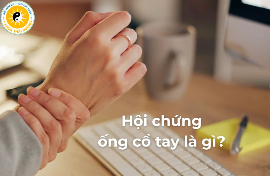 Hội chứng ống cổ tay ở nhân viên văn phòng: Nguyên nhân và cách phòng ngừa