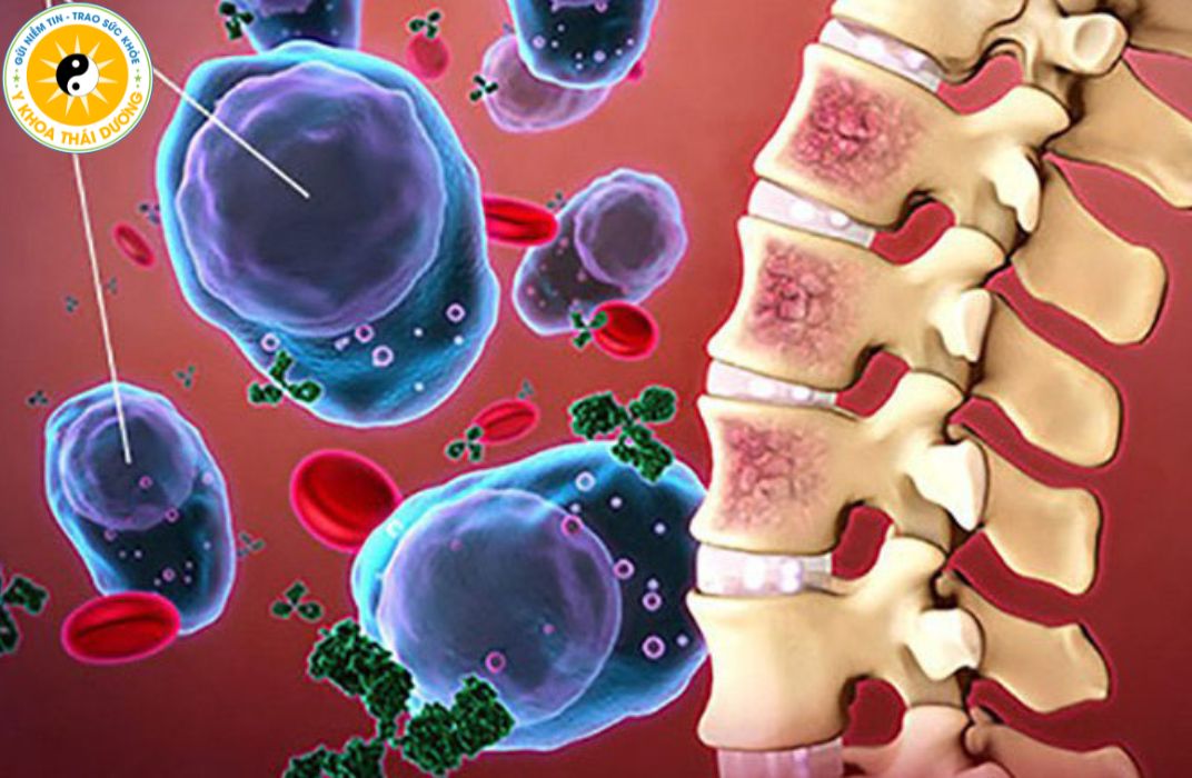 Nguyên nhân gây rối loạn cơ xương khớp