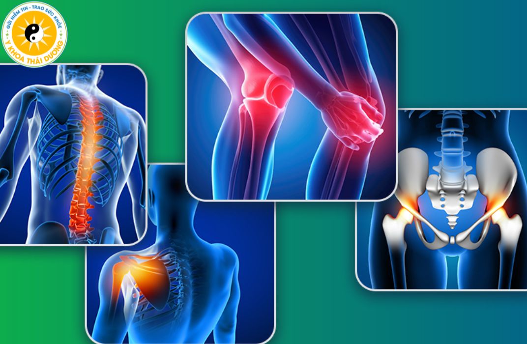 roi loan co xuong khop 4