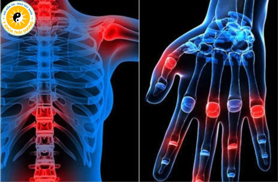 Rối loạn cơ xương khớp: Nguyên nhân, cách điều trị và phòng ngừa hiệu quả