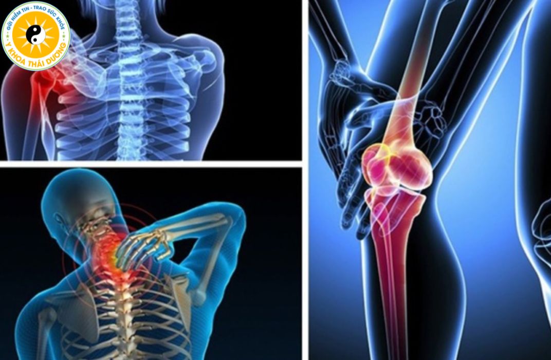 Tầm soát xương khớp định kỳ: Vì sao người trưởng thành nên thực hiện?