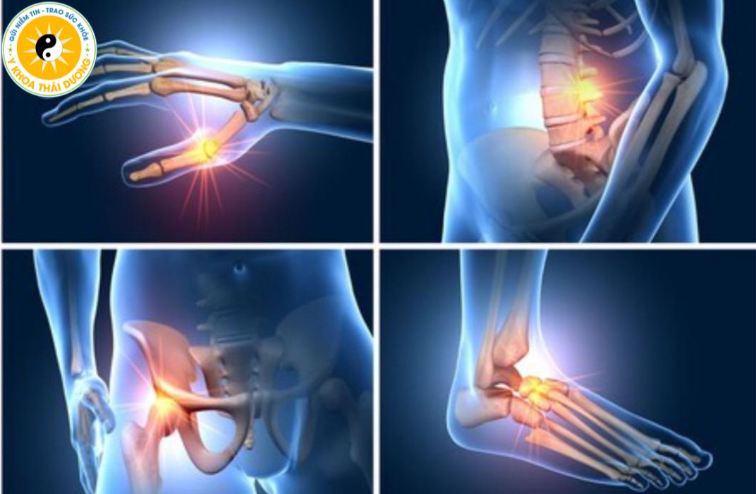 Tầm soát xương khớp định kỳ: Vì sao người trưởng thành nên thực hiện?