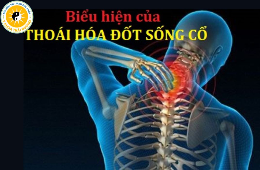 Thoái hóa cột sống thắt lưng và cổ: Triệu chứng và cách điều trị