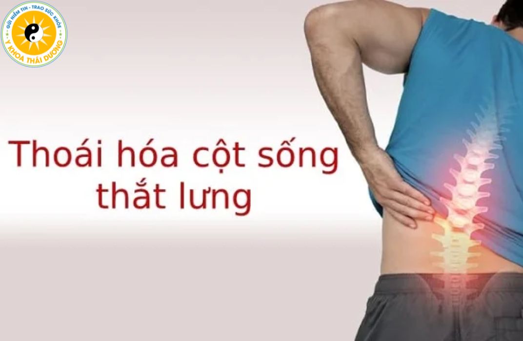 Thoái hóa cột sống thắt lưng và cổ: Triệu chứng và cách điều trị