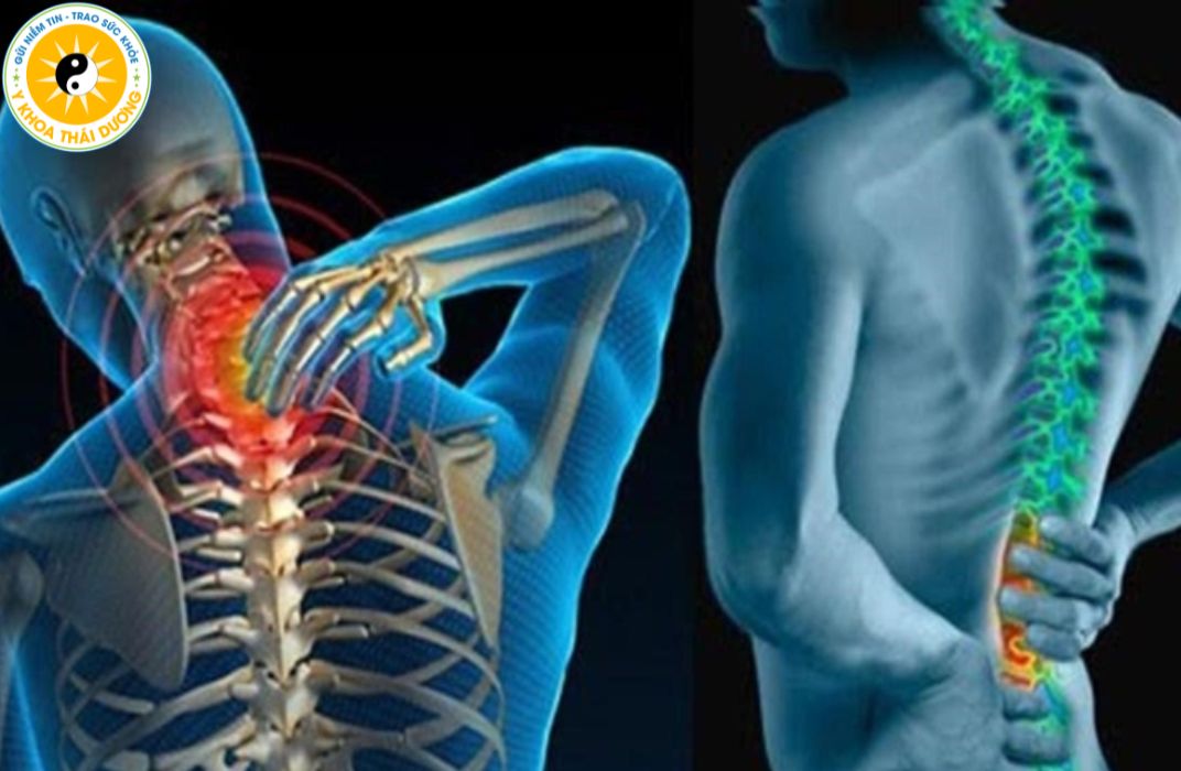 Thoái hóa cột sống thắt lưng và cổ: Triệu chứng và cách điều trị
