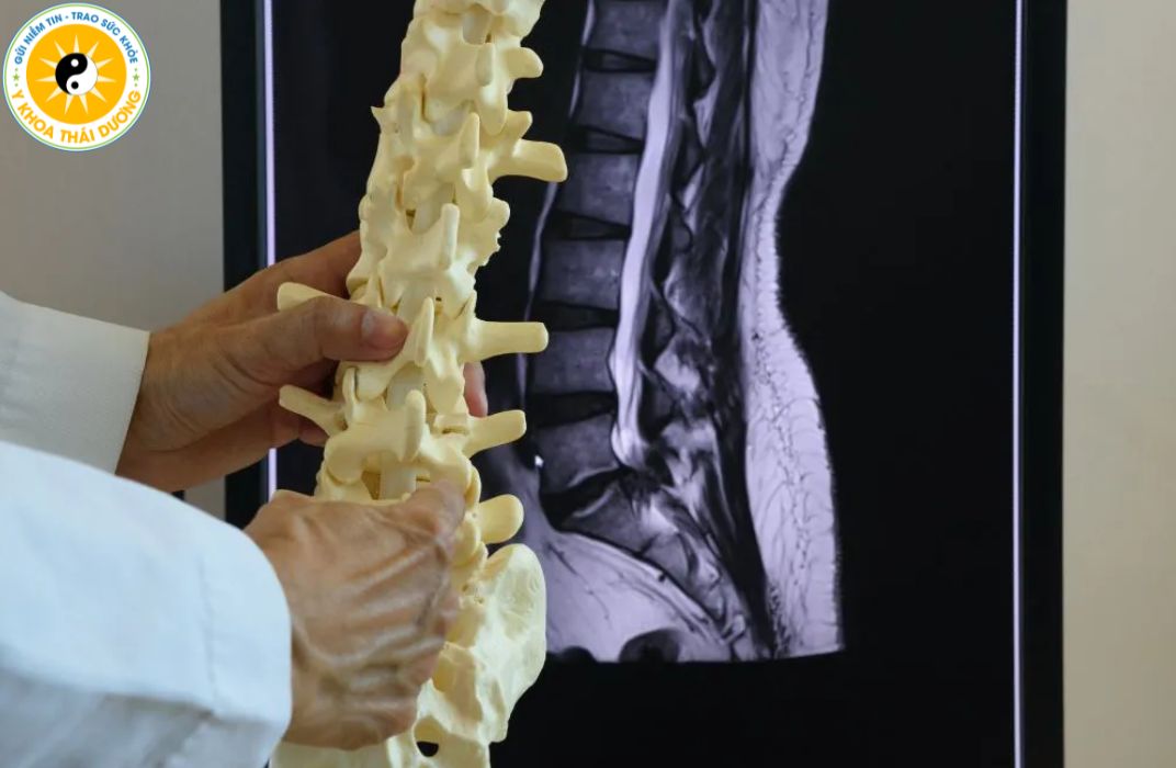 Thoái hóa khớp - cột sống: Nhận biết sớm và phác đồ điều trị hiện nay