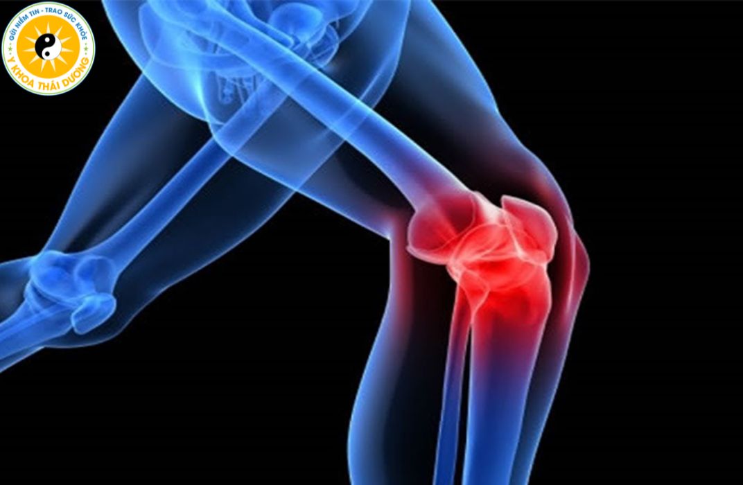 Thoái hóa khớp gối: Nguyên nhân, biểu hiện và hướng điều trị