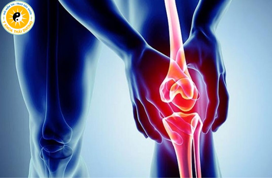 Thoái hóa khớp gối: Nguyên nhân, biểu hiện và hướng điều trị