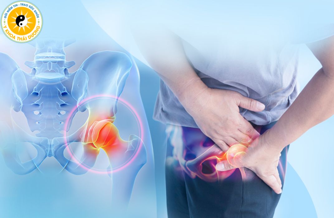 Thoái hóa khớp háng: Khi nào cần can thiệp y khoa?