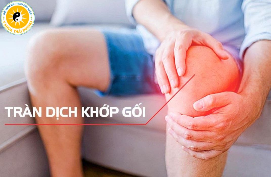 Tràn dịch khớp gối: Các phương pháp điều trị không phẫu thuật đang được áp dụng