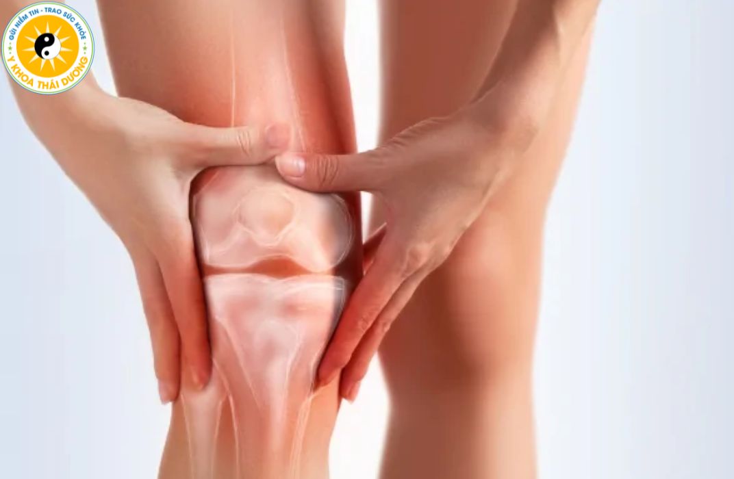 Tràn dịch khớp gối là gì? Dấu hiệu nhận biết sớm và mức độ nguy hiểm
