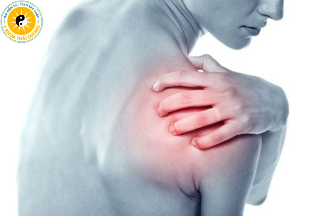 Trật khớp vai: Nhận biết triệu chứng và cách phòng ngừa an toàn