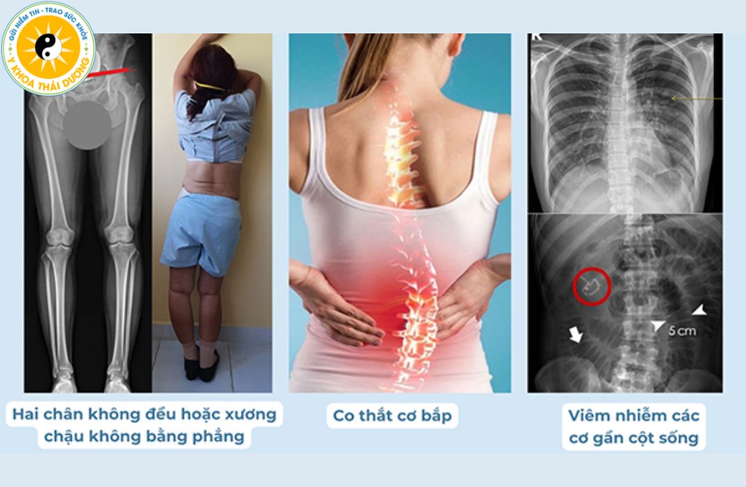 vi-sao-hoc-sinh-de-bi-cong-veo-cot-song-3