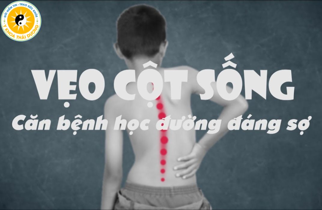 vi-sao-hoc-sinh-de-bi-cong-veo-cot-song-3