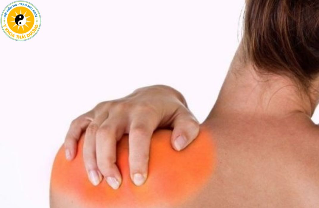 Viêm cơ: Khi nào cần điều trị bằng vật lý trị liệu?