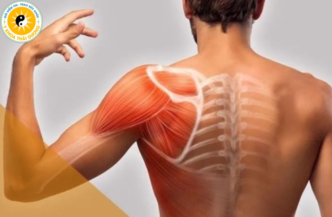 Viêm cơ: Khi nào cần điều trị bằng vật lý trị liệu?